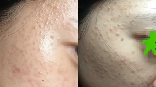 24歲女染愛滋「三任男友他最可疑」 她崩潰:我沒濫交約砲為何該死?