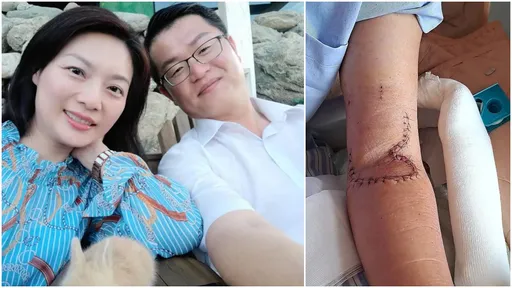 議員遭妻砍傷!妻反咬「他拿家電砸我」 警分局長不認拐人妻告誹謗