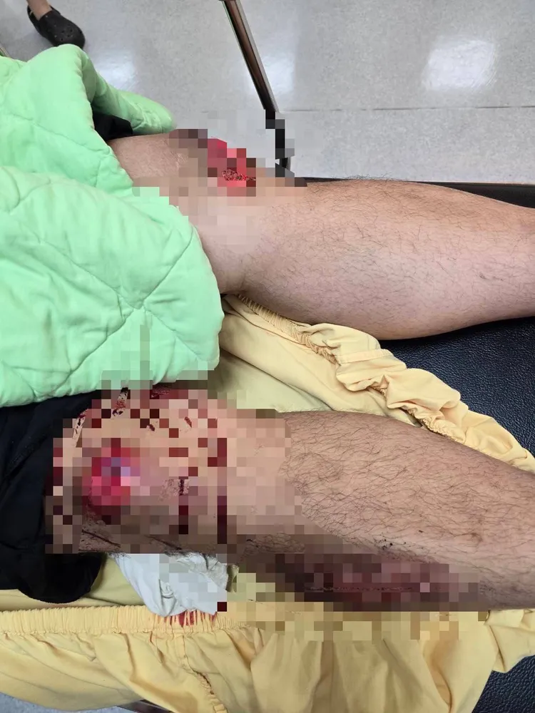 因公車漏油導致多名騎士不慎慘摔。翻攝照片