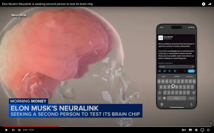 在腦內植入Neuralink公司開發的裝置後甚至可以透過腦內神經打出文字訊息。 翻攝自德國之聲