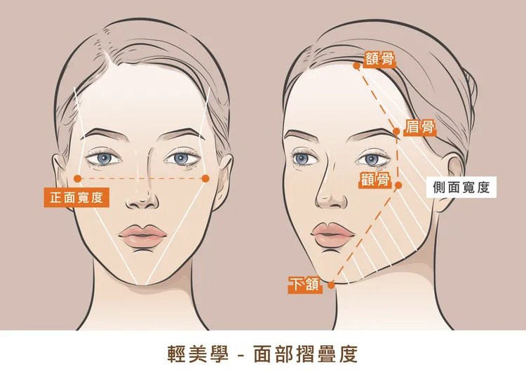 秘境美學診所－輕美學「面部摺疊度」示意圖