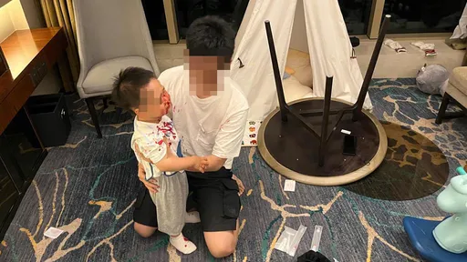 親子房3腳桌傾倒「2歲童被砸滿臉血」 飯店:正常使用沒安全問題