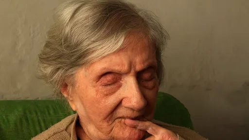 減緩阿茲海默症新藥問世! 美國FDA批准多奈單抗上市