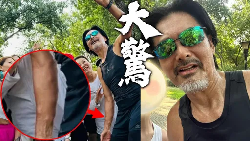69歲周潤發還好嗎?不只大腿凸兩粒 手臂冒出多顆大肉球