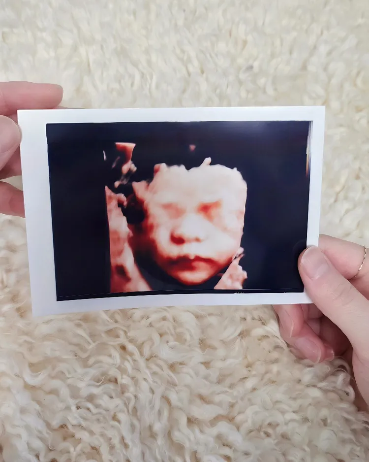 晟敏曬出胎兒超音波照。翻攝_liustudio_ IG