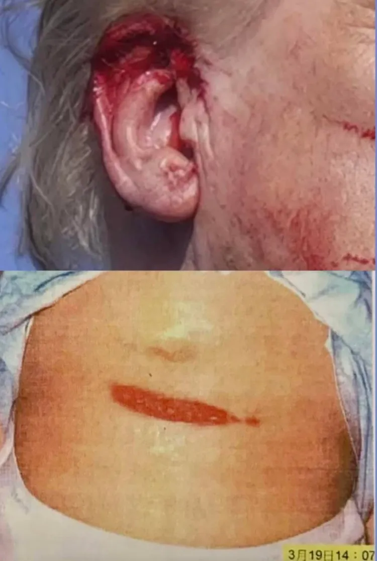 前總統陳水扁曬出和川普槍傷對比照。翻攝陳水扁臉書