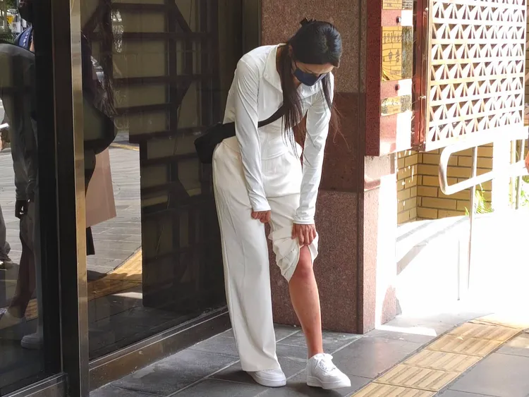 謝女掀開褲管秀出腿部傷痕。張欽攝影