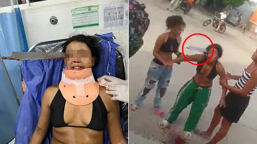 14歲少女「臉部中刀」血染街頭 恐怖!她為友出頭被長刀貼眼直插