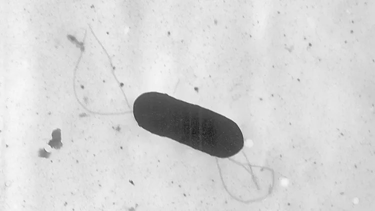 李斯特菌感染通常會引起發燒、肌肉疼痛和疲倦，並可能導致頸部僵硬、意識混亂、失去平衡和抽搐。美聯社