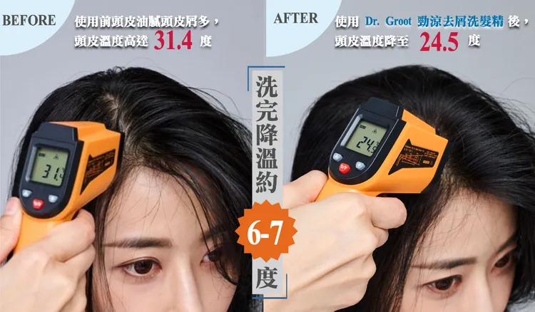▲ 使用溫度測量儀測試，洗前頭皮悶熱出油又有頭皮屑，溫度高達約31.4度，使用後則為24.5度，直接大降6.9度，果然是頭皮降溫好物！
