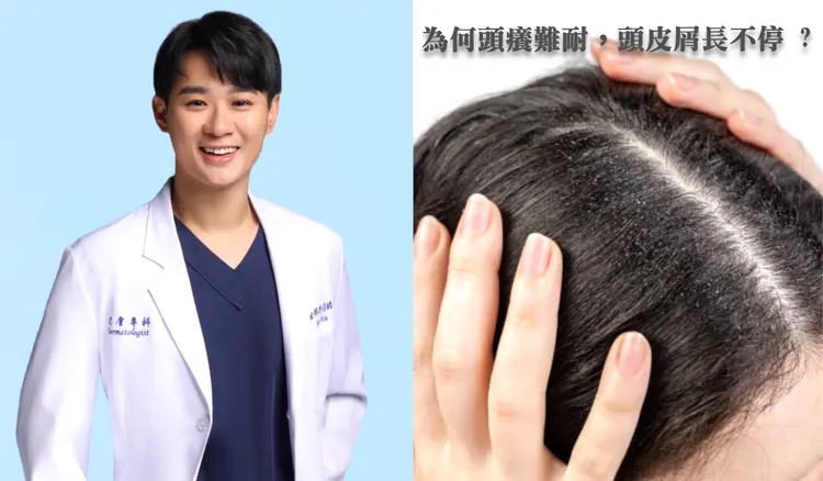 ▲ 皮膚科許淳皓醫師表示，頭皮出油生頭皮屑，除了清潔要注意，更要慎選洗護髮品。