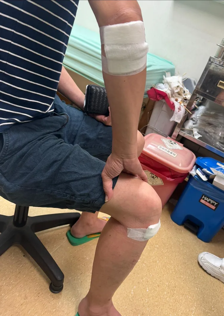 該名父親車禍後回診，手肘、膝蓋換藥時因劇烈疼痛抖動。翻攝嚴可倫臉書