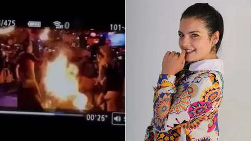 驚悚影片|正妹餐廳火焰舞「真變火人」 全身80%燒傷命危