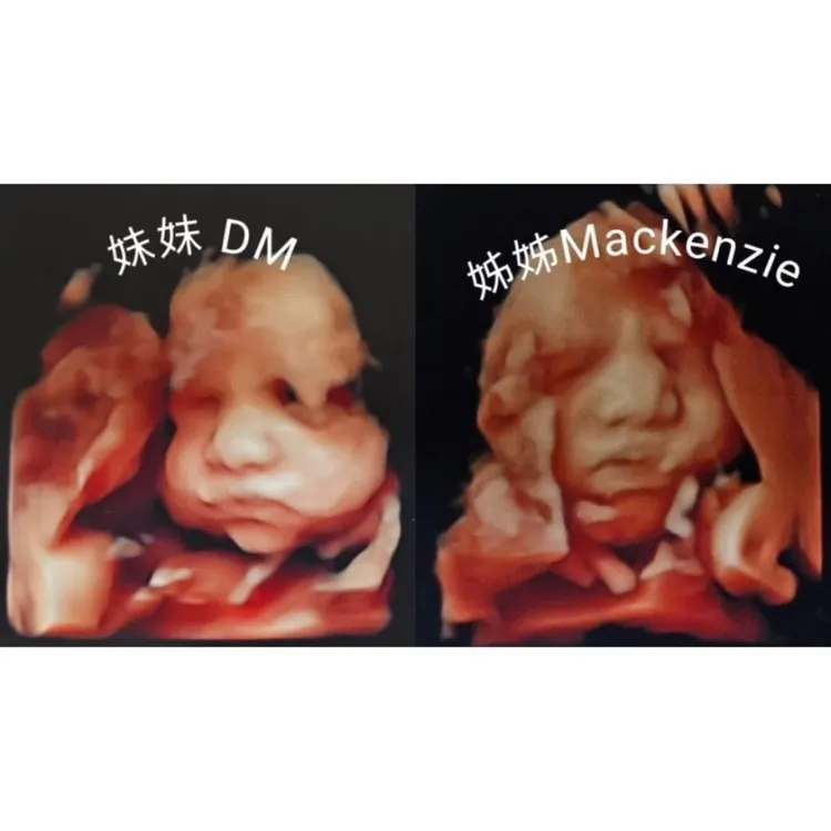 葉瑋庭曬出大女兒與二女兒的超音波對照圖。翻攝葉瑋庭臉書