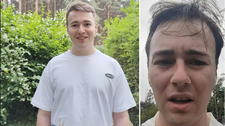 英國帥哥Jack分享2年前到中國公司工作前的帥照（左圖），以及工作２年後的崩壞照。翻攝微博/每日人物Jack