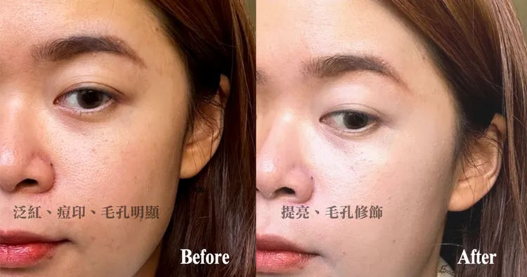 ▲ 原本臉上因為毛孔、痘印，泛紅呈現小花貓臉，擦上薄薄上一層Za美白隔離霜勻透綠，臉一下變乾淨了。