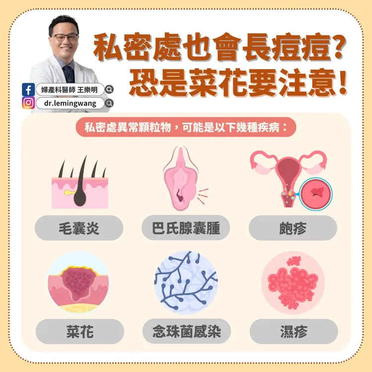 婦產科醫師王樂明指出，私密處長痘痘等異常可能是由多種疾病引起，包括毛囊炎、巴氏腺囊腫、皰疹、菜花、念珠菌感染及濕疹等。取自婦產科醫師王樂明粉專