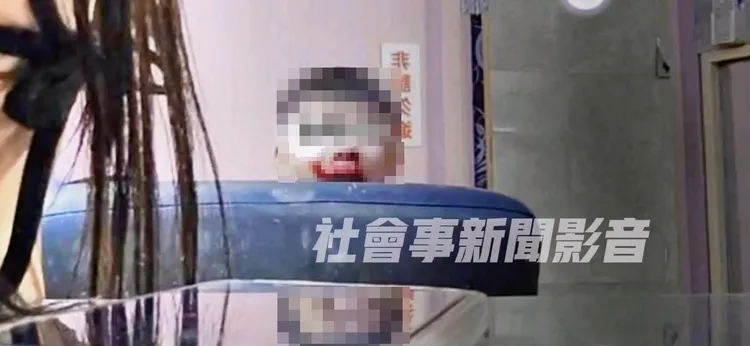 男童疑被檳榔西施母打到口鼻流血。翻攝「社會事新聞影音」