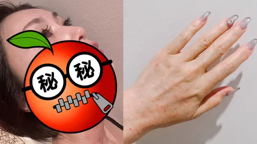 擋泥板女神秀愛美的代價 網驚:光看照片就好痛