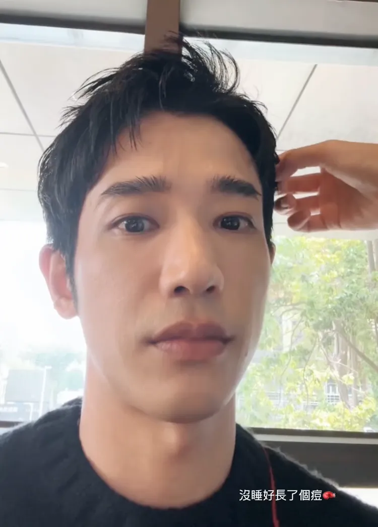 劉以豪透露昨日沒睡好臉上長了顆痘痘。翻攝劉以豪IG