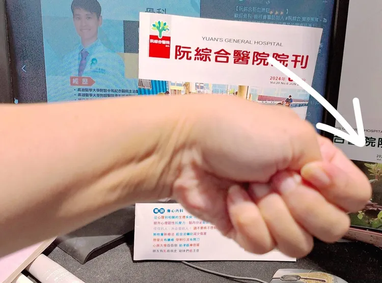 醫師曾祥睿建議兩招大拇指運動，可徒手、用橡皮筋輔助，病症輕微者可收到改善效果。阮綜合醫院提供