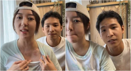 五熊車禍被撞飛「瞬間看不到」　曝胸口大片瘀青照：覺得活不下來