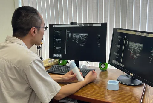 智慧醫療再突破　華碩推全新超音波AI平台