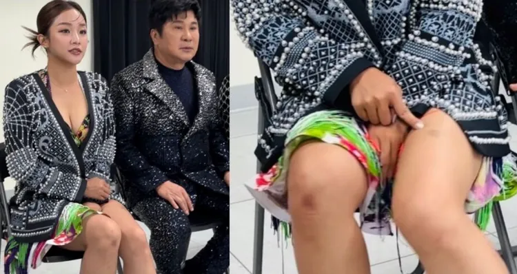 賴慧如為了練舞練到滿身瘀青，被疑是老公家暴。林丞偉攝