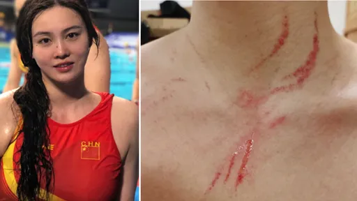 來互相傷害啊!澳洲、中國水球隊互秀胸口抓痕 小粉紅網友:抓回去就對了