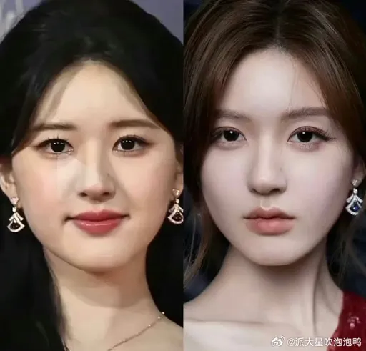 趙露思深陷「動臉疑雲」對比照差很大!狗仔狠評「快認不出來了」