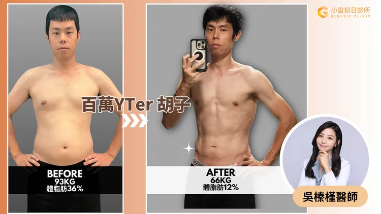 百萬YouTuber「胡子Huzi」減肥成功。小宙初日診所提供