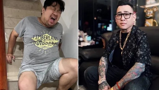 統神還沒拳打蹦闆先自爆!痛風發作下樓梯慘樣曝光