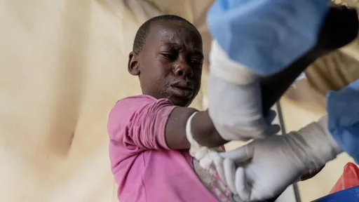 世衛:M痘疫情非另一次COVID 傳染能夠被控制