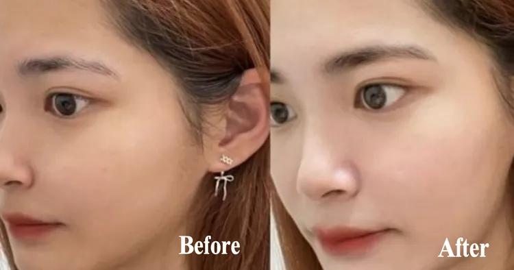 ▲ 使用前後膚色明顯提亮。