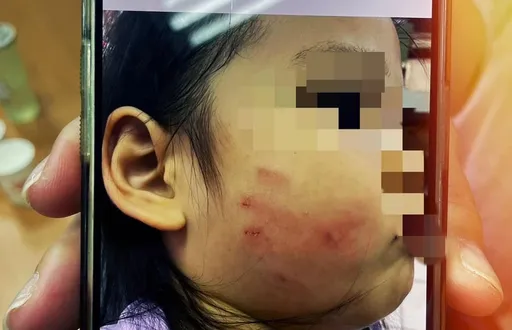 桃園幼兒園虐兒！　女童午休發出聲響遭教保員呼巴掌