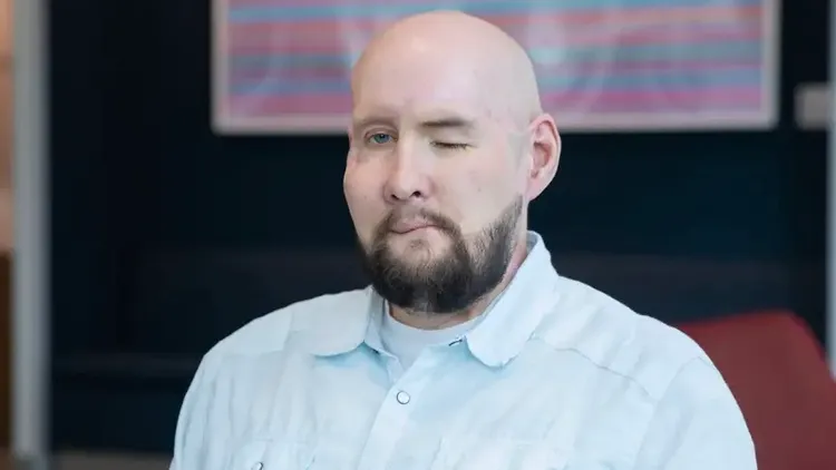 詹姆斯在術後接納新的自己，並打算重啟人生。翻攝自DW