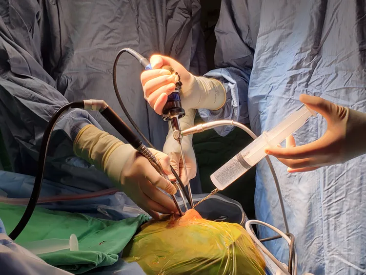 2人4手完成難度極高的手術。台北榮總提供