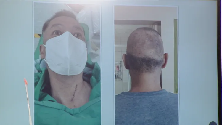 汪建民癌末歷經掉髮。和展影視提供