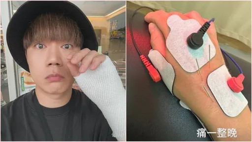 李岳主持活動後急就醫　「包整手」醫曝肌肉都發炎了
