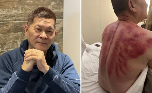 68歲澎恰恰陸劇一拍18小時　拚還債背上滿是紅痕