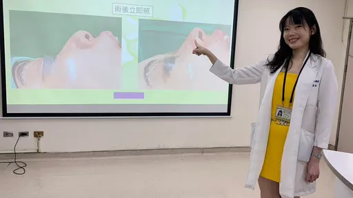 熟女鼾聲大到和老公分房睡 這手術治好呼吸中止症!還讓她變美了