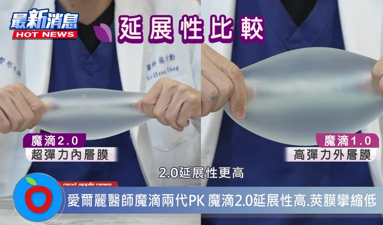 魔滴 JOY 超彈力內層膜設計，延展性更是超過 800%，可以大幅縮小手術切口外，對於在意傷口大小、術後修復的消費者來說，是一個非常好的選擇。