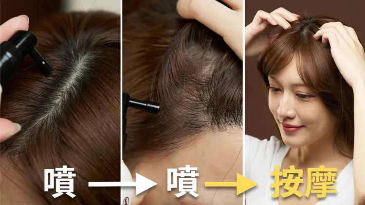 ▲明顯看到頭皮的地方都可以使用