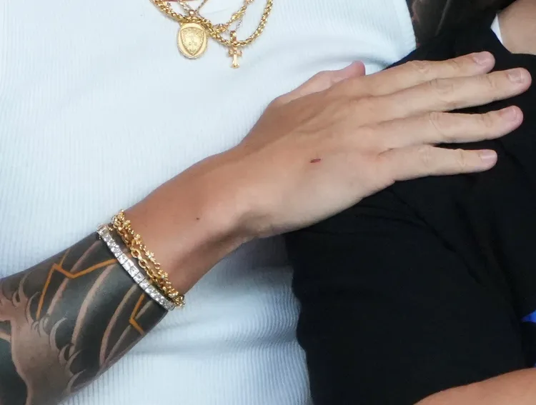 王陽明秀出「愛的傷痕」。彭欣偉攝