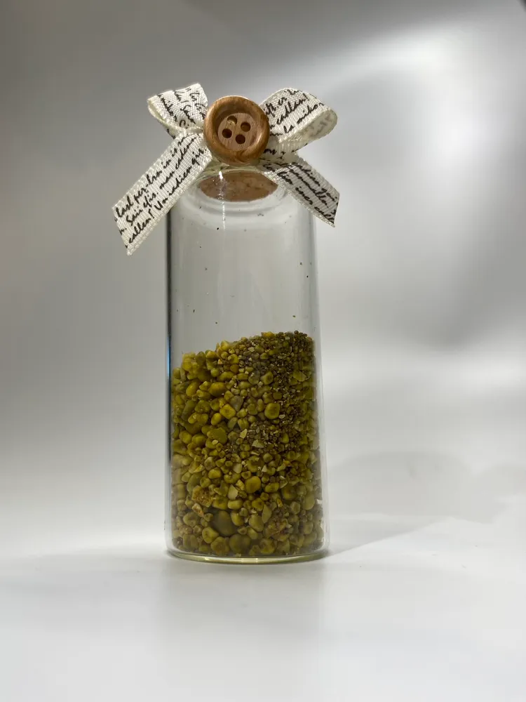 博田國際醫院將取出的膽結石處理後裝瓶，祝福女工程師平安健康。博田國際提供