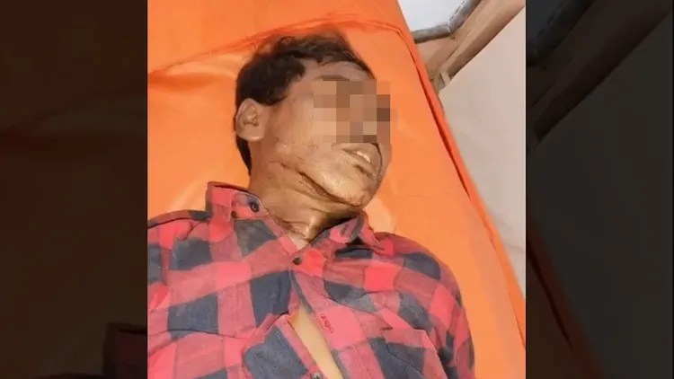 竊賊全身上下只有頸部有傷痕。翻攝自X