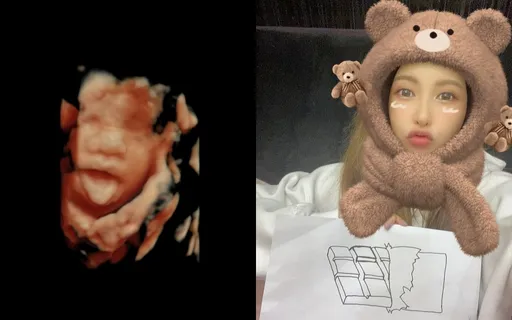 神隱4年!愷樂親自宣布懷孕喜訊 突曬寶寶超音波照「Hello,9月」