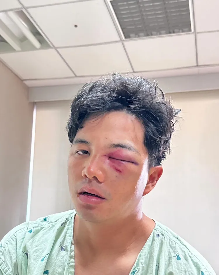 吳念庭曝光傷後照片。翻攝自吳念庭臉書