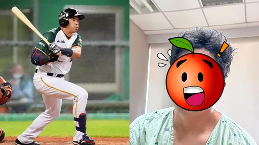 吳念庭遭強襲球爆頭 驚悚「破相照」正面曝光