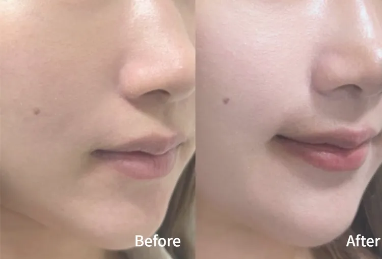 ▲ 使用前膚色雖然白，但顯得沒精神，使用後粉嫩水光感都出來了，看起來還有一點澎潤的感覺呢。